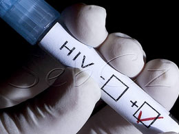 hiv test
