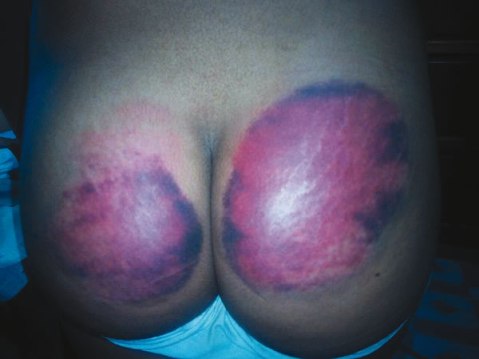 whip-Lagos-schoolgirl’s-buttocks