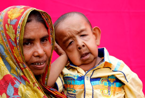 The-Boy-Who-Looks-Like-An-Old-Man-BORN-DIFFERENT